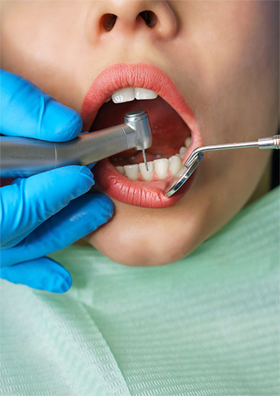 dental service