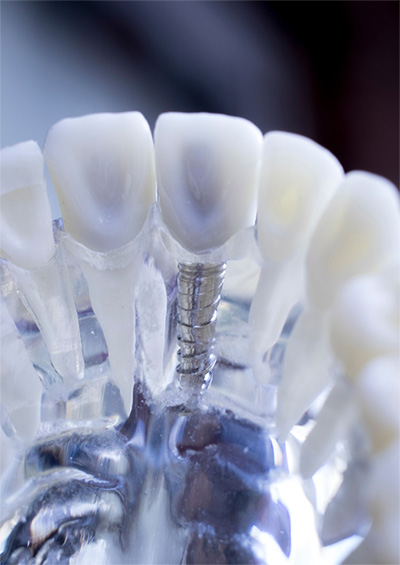 dental service