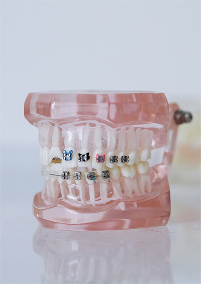 dental checkup