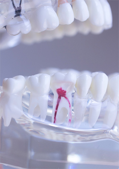 dental checkup